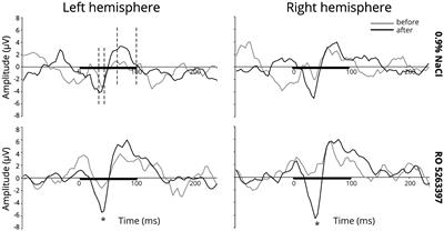 Trace Amine-Associated Receptor 1 Agonist Modulates Mismatch Negativity-Like Responses in Mice